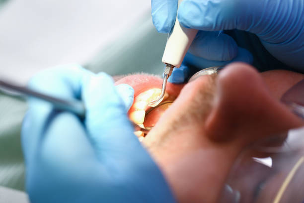 Best Emergency Dental Care for Broken or Chipped Teeth in Langston, OK
