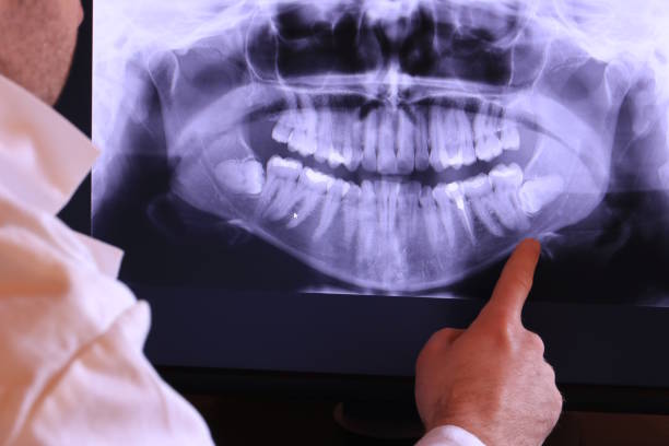Best Emergency Treatment for Dental Infections or Abscesses in Langston, OK