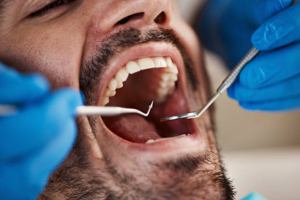 Best Cosmetic Emergency Dentistry in Langston, OK